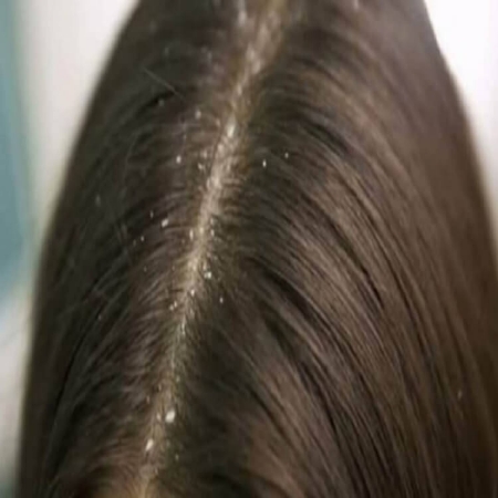 صورة للفئة القشرة 