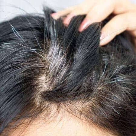 صورة للفئة الشيب