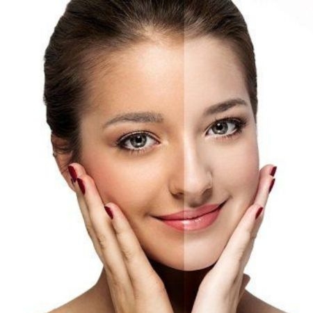 صورة للفئة تفتيح البشرة