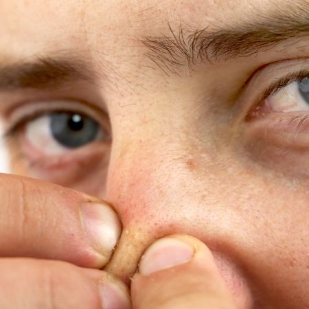 صورة للفئة  الرؤوس السوداء والمسامات