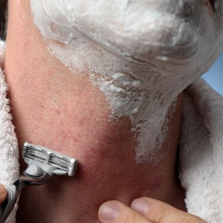 صورة للفئة شفرات الحلاقة